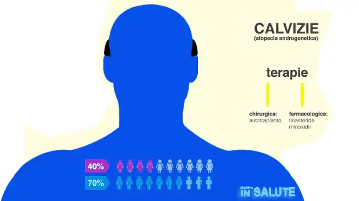 Schema calvizie uomini (60%) e donne (40%) e indicazione delle terapie (autotrapianto e farmacologiche)