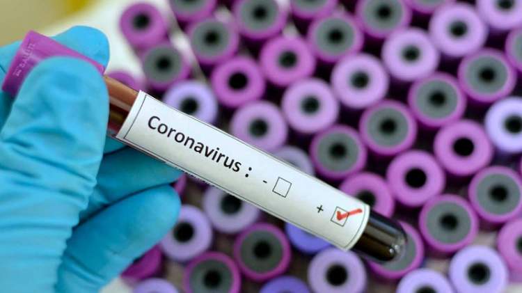 Medico tiene in mano una fiala di sangue per il controllo del coronavirus