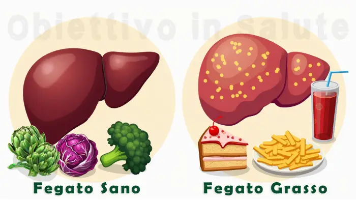 Illustrazione che mostra un confronto tra un fegato sano e un fegato grasso. Il fegato sano è di colore rosso scuro e uniforme, con una superficie liscia. Il fegato grasso è ingrossato, con macchie giallastre e una texture irregolare. Sullo sfondo del fegato sano sono presenti dei vegetali (radicchio, broccoli, carciofo), mentre sullo sfondo del fegato grasso c’è una fetta di torta, una porzione di patatine fritte e una bibita gassata